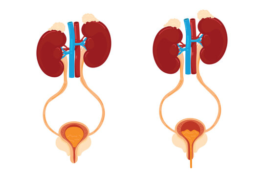Human Urinary System Anatomy Set. Vector illustration of kidneys and bladder filling and emptying. Micturition process comparison.