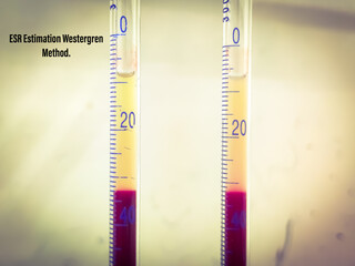 Westergren method is a standardized test for measuring the erythrocyte sedimentation rate (ESR), which indicates the rate at which red blood cells settle in a tall, thin tube over one hour.