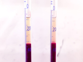 Westergren method is a standardized test for measuring the erythrocyte sedimentation rate (ESR), which indicates the rate at which red blood cells settle in a tall, thin tube over one hour.
