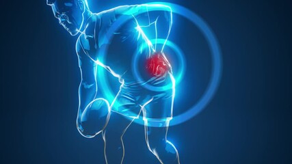 Conceptual 3D animation of a rugby player with back pain