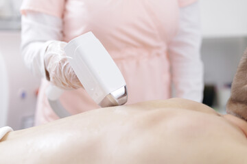 Laser hair removal procedure on male back in clinic setting, white light