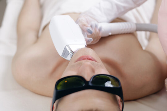 Laser hair beard and mustache removal on male face with advanced technology, top view