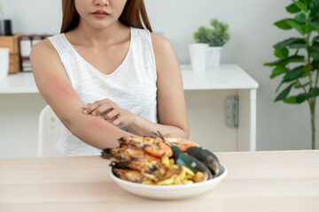 food allergies, women have reactions itching and redness after eating shrimp, seafood allergy, itching, rash, abdominal pain, diarrhea, chest tightness, unconsciousness, death, severe avoid allergies