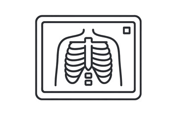 Medical -ray image of human chest showing rib cage and sternum on a diagnostic screen
