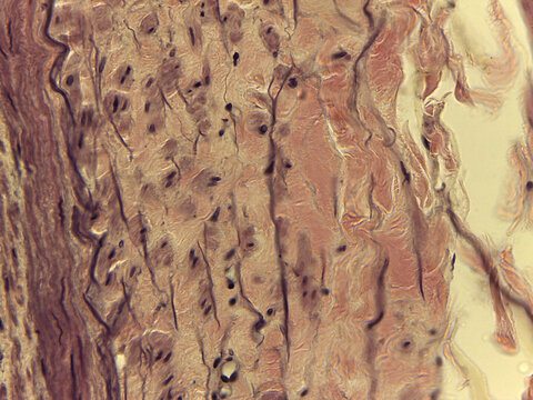 Detailed Histological View of Fibrous Connective Tissue: Parallel Wavy Collagen Bundles and Flattened Fibrocytes in a High-Stress Stru