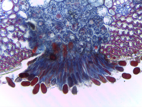 Stained Cross-Section of Puccinia graminis Rust Fungus Sorus Showing Mass Production and Release of Teliospores/Urediniospo