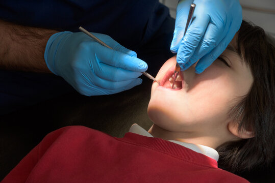 Children dental health. Boy at the dental office. Dentist examining child's teeth in clinic in regular dentistry check up. Pediatric dentist examining his patient with mouth open in dental clinic. - Powered by Adobe