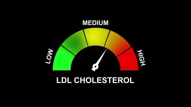 Ldl Cholesterol Gauge Meter Showing Medium Level With Color Zones Green Yellow Orange Red. 4K motion animation on a transparent background alpha channel.
