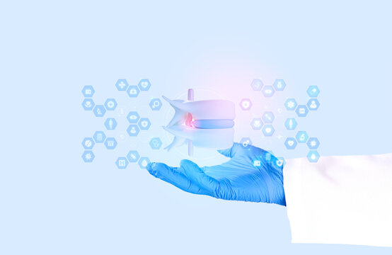 Hand of an orthopedic surgeon examining a model of a lumbar disc herniation. Concept of spinal diagnosis, nerve compression assessment, and spinal health. Isolated.