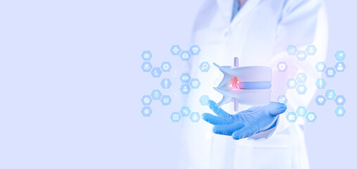 Orthopedic surgeon in a white coat showing a model of a lumbar disc herniation. Concept of spinal health, nerve compression, inflammation, and lower back pain.