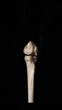 Anatomical study of a knee joint bone against a dark background with the faint silhouette of a leg showcasing human anatomy for medical study
