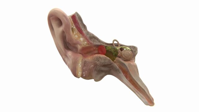 Video of Acute otitis media ear | Acute otitis medias video in vertical | Ear Infections video