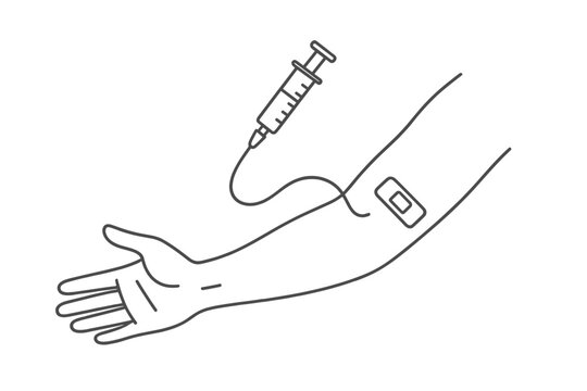 Blood donation process showing a syringe and bandage on a volunteer's arm in a clean clinic setting