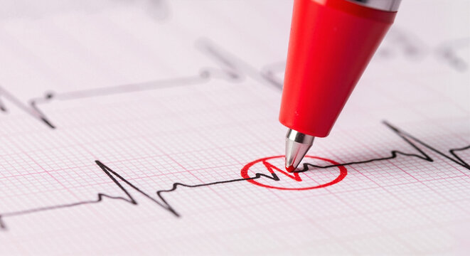 Red pen tip checking vital signs data on printed electrocardiogram paper graph