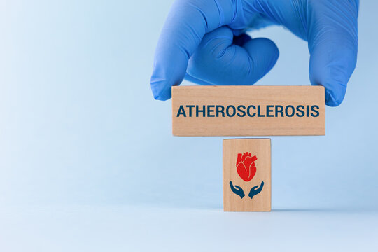 A doctor wearing gloves places wooden cubes with a heart icon on a light blue background. Concept of heart health, atherosclerosis awareness, and cardiovascular disease prevention.