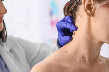 Dermatologist examining mole on woman's neck in clinic, closeup