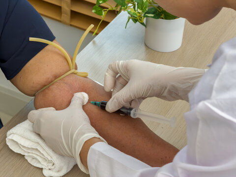 Close up of doctor or nurse taking blood sample from arm vein with vacutainer. syringe to venipuncture the patient