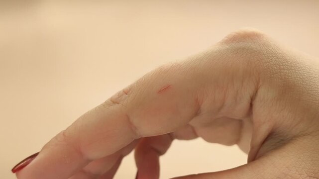 Scratch, cut on the index finger of the hand.