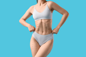 Fototapeta premium Young woman in underwear with marks on her body against blue background. Liposuction concept