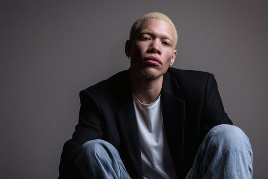 albino african american man in professional studio setting with plain background
