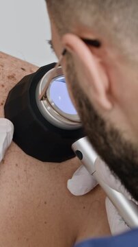 Vertical cropped shot of unrecognizable male doctor holding dermatoscope and inspecting patients skin disease in clinic