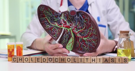 Woman doctor holds detailed anatomical model of liver. Miniature wooden cubes arranged neatly form medical term Choledocholithiasis on table