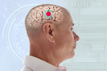 senior man with transparent skull showing brain activity, red dot neural focus, neuroscience artificial intelligence connection human brain function, futuristic circuit board background technology