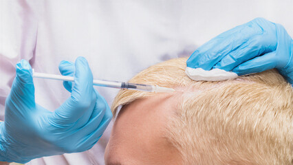 Scalp microinjection procedure performed specialist in blue gloves, applying injectable therapy hair restoration, biostimulation, growth-factor activation, advanced non-surgical trichology treatment