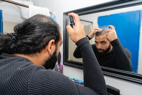 Colombian man with beard applying hair loss spray to thinning scalp areas during treatment routine.