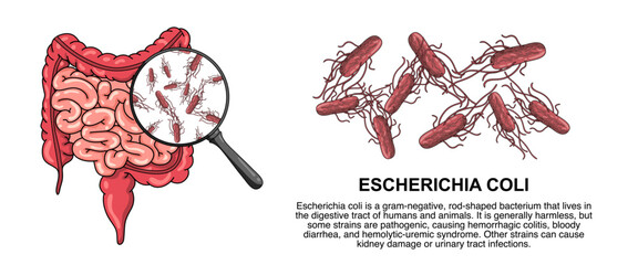Illustration of escherichia bacteria. e.coli, bad bacteria in the human body. dangerous micro organisms, vector illustration for medical posters, treatment, or clinics.
