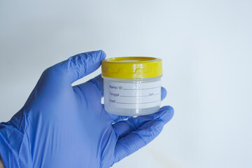 Nurse holding container with urine sample at table, closeup and space for text. Specimen collection