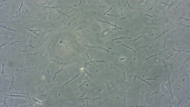 Many long curved bacterial spirilla cells moving under microscope magnification on a glass slide.