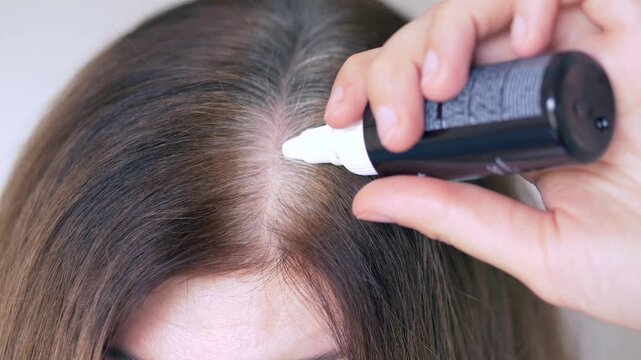 Precise scalp treatment applied to reduce gray hair visibility and support healthy roots. Gray hair control routine focuses on vitamins, gentle care, slowing early gray hairs caused by genetics stress