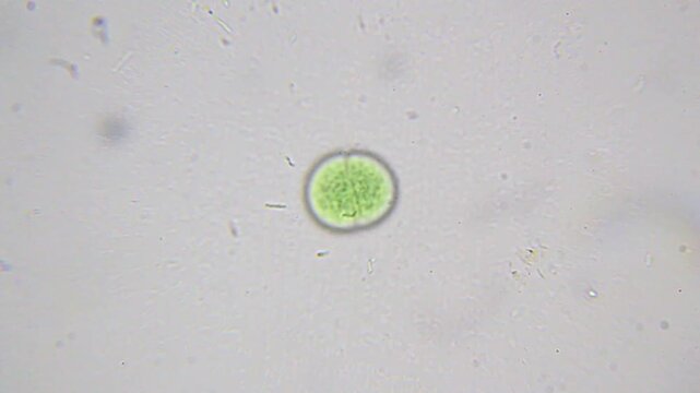 Dividing cyanobacterium surrounded by actively moving bacteria, captured at 2000x brightfield microscopy with oil immersion in high detail.