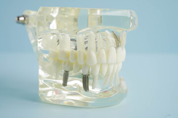 Dental teeth model on white background for learn about dentistry.