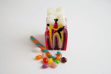 Treatment dental care cost, dental expense or fee, US dollar banknote money with teeth model.