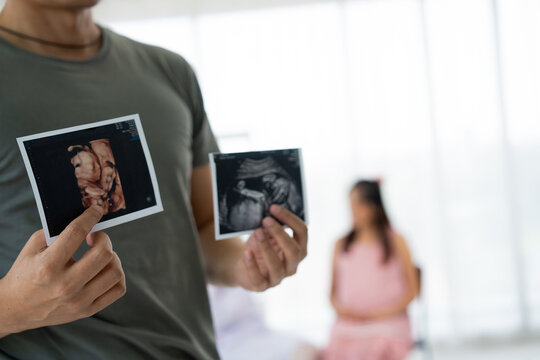 Asian husband hold ultrasound Images of His Unborn Child and pregnant women visit obstetrician for consulting in medical clinics or hospitals planning pregnancy. planning pregnancy, trust and respect