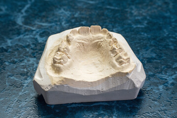 Dental plaster cast on a blue background in a dental laboratory