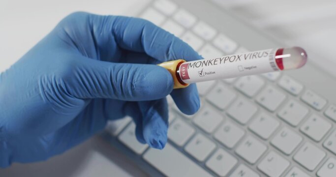 Grasping blue nitrile-gloved hand holding blood tube with yellow cap, MONKEYPOX label at lab bench - Powered by Adobe