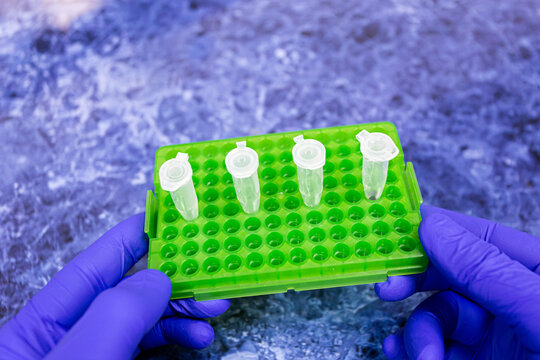 Close-up of a green plastic laboratory stand with four sample tubes in the hands of a scientist.