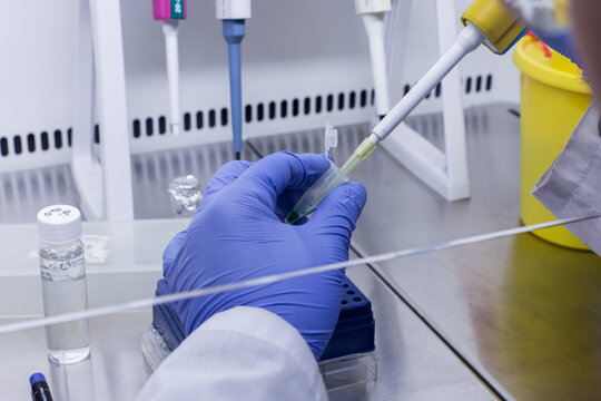 A scientist adds the sample to be tested to a small test tube using a thin tip and an automatic dispenser.