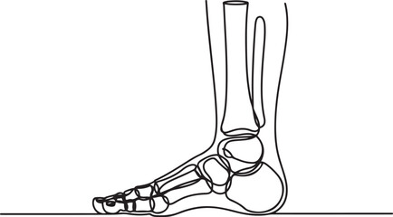 Fractures of human foot bones. Fractures in different places of the leg due to injury. Vector illustration. one line Icon drawing