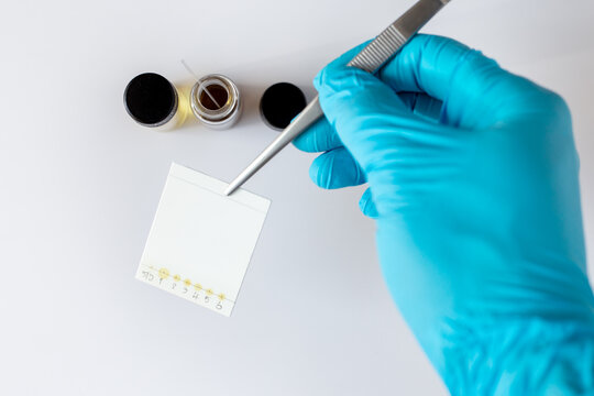 A scientist uses forceps to hold a Thin Layer Chromatography (TLC) plate containing sample spots, preparing to place it into a mobile-phase solvent tank for chemical analysis.