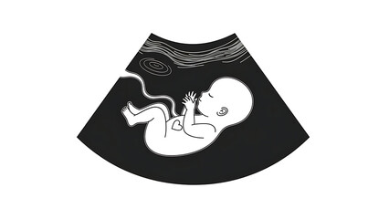 Stylized black and white ultrasound image showing a fetus with an umbilical cord inside the womb, representing prenatal development.