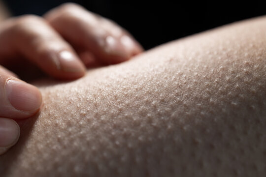A hand lightly touches skin with raised bumps as a reaction to cold air. The surface appears smooth but has distinct goosebumps all over. This scene captures a moment of physical response.