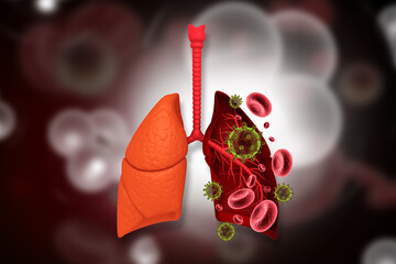  Human lungs infected by a virus, showing inflammation, fluid accumulation in the alveoli, and potential COVID-19 related damage. 3d illustration
