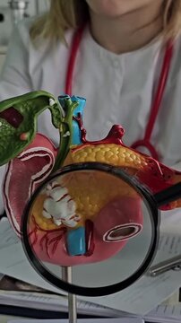 Anatomical model of the pancreas, duodenum, and spleen. Diseases and treatments for liver, spleen, and pancreas lesions concept