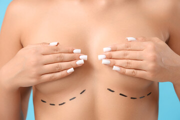 Young woman with marking on breast against blue background, closeup. Plastic surgery concept