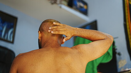 Close-up image of a patient applying healing cream to the donor area on the back of the scalp three days after a hair transplant procedure.