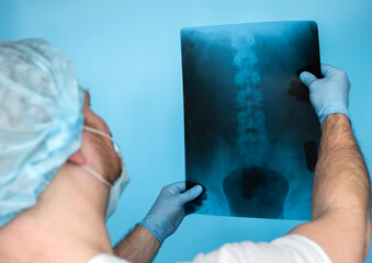 A doctor holding an X-ray of the spine. Diagnosis of the human spine.